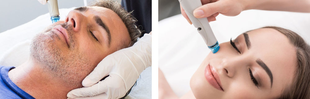 hydrafacial-vejle-ansigtsbehandling-ham-hende-topclinic-gavekort